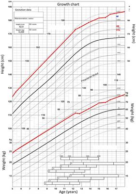 Case Report: Bilateral Epiphysiodesis Due to Extreme Tall Stature in a Girl With a De Novo DNMT3A Variant Associated With Tatton-Brown-Rahman Syndrome